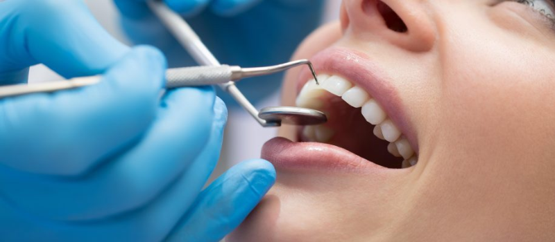 Dentist at Home in Hyderabad