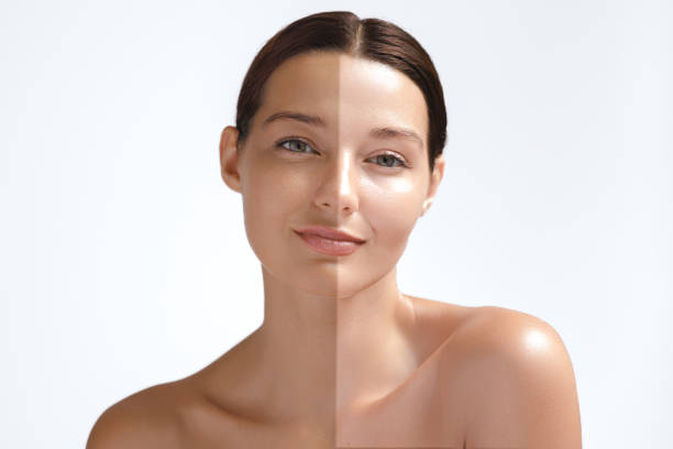 Skin Whitening Benefits: How Glutathione Injections at Home Can Help You Achieve Radiant Skin in Hyderabad